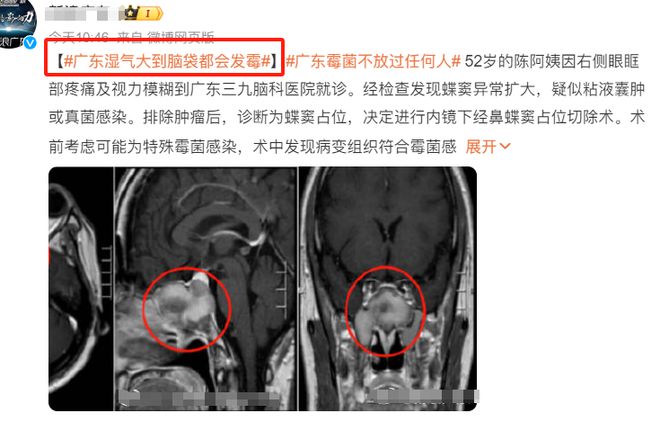 js金沙老品牌霉比砒霜毒68倍？！白墙霉斑一喷即净5分钟斩「霉」除根家里潮湿角落全用它(图7)